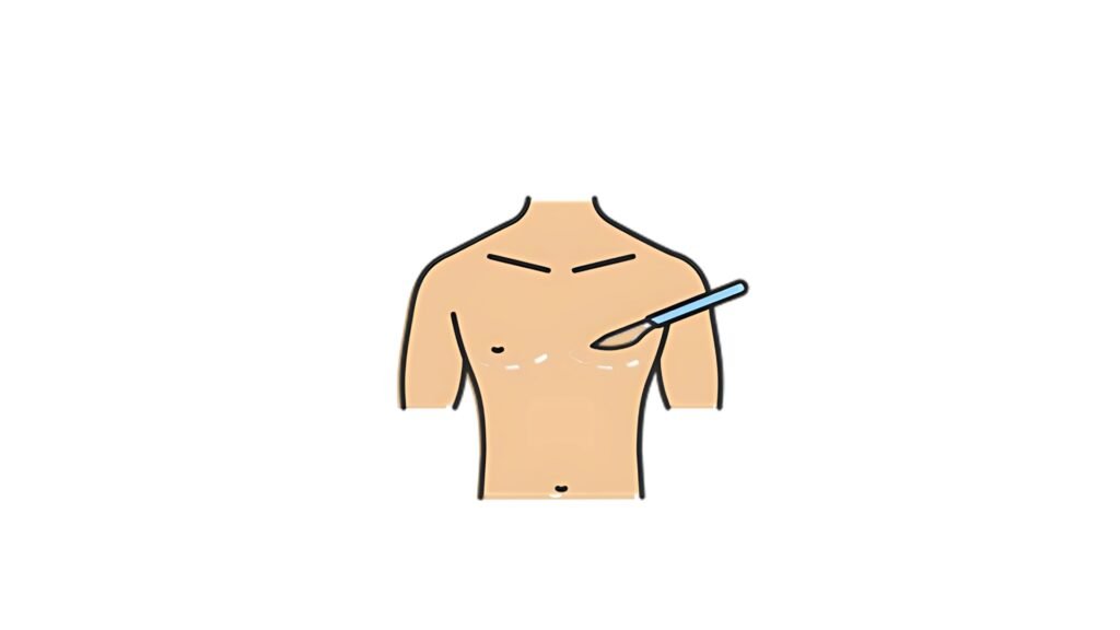 gynecomastia surgery