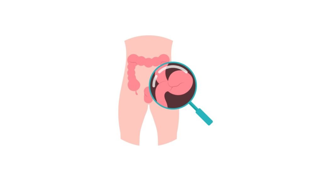 hernia treatment in Delhi, India