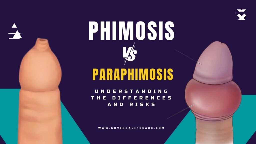 Phimosis vs. Paraphimosis: Understanding the Differences and Risks