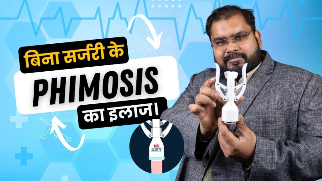 I Have Phimosis and Don’t Want Surgery: Phimosis Treatment Without Surgery